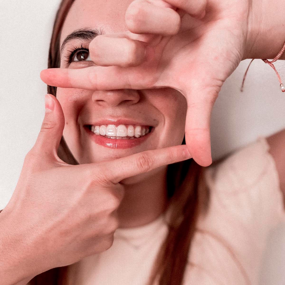 Sonrisa con alineadores LINNERS